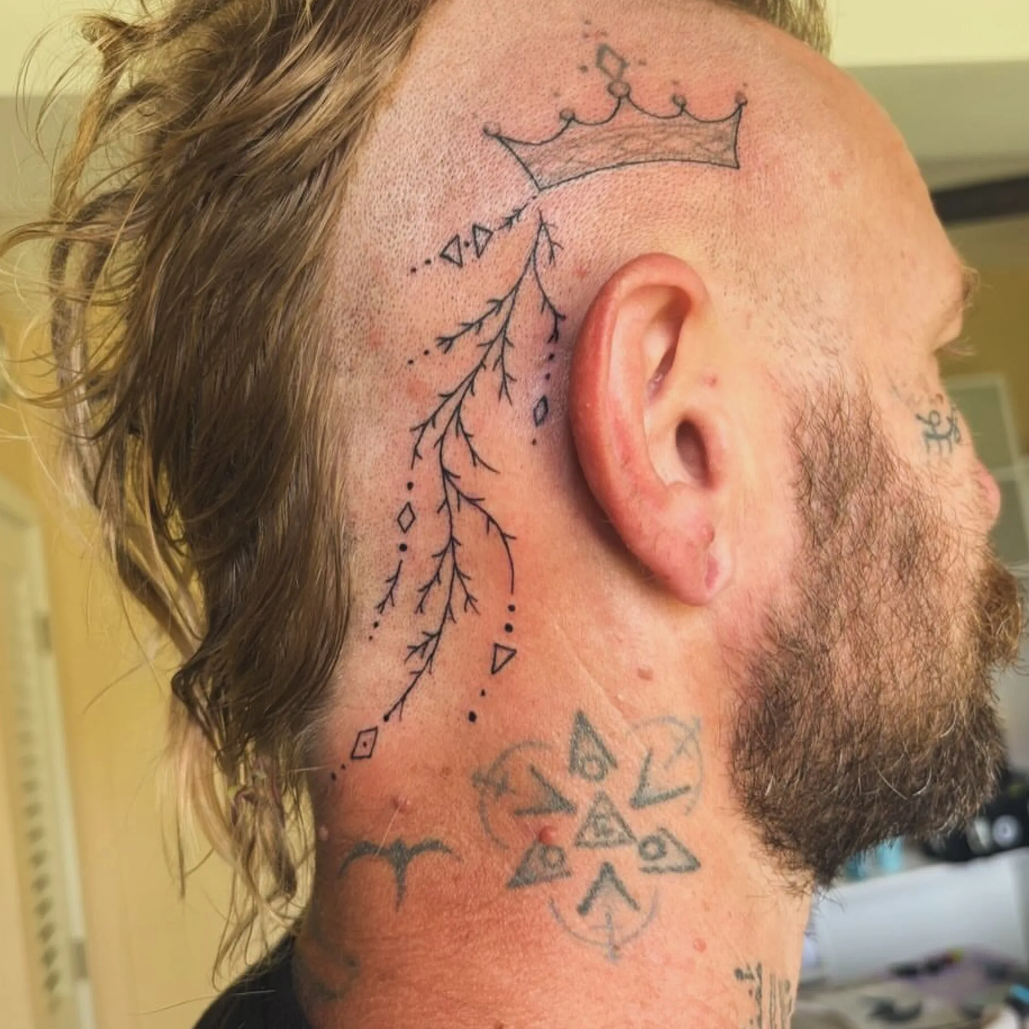 sharp scalp tattoo