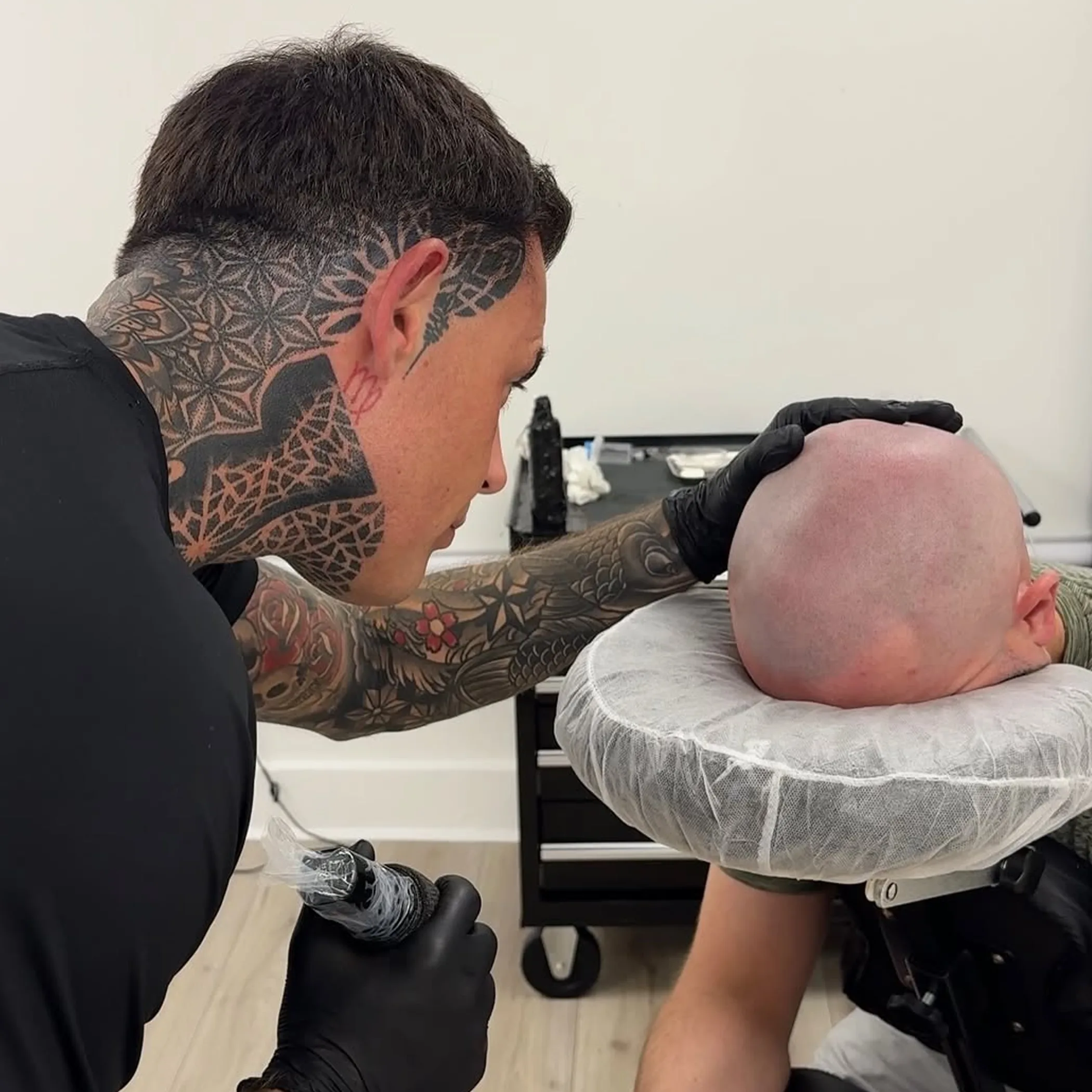 scalp micropigmentation treatment